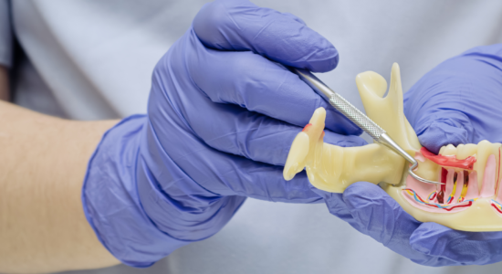 Periodontia em Balneário Camboriú
